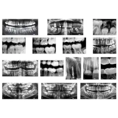 Roylco&reg; Dental X-Rays