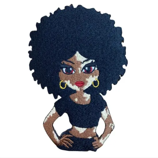 Vitiligo Afro Patch {2}