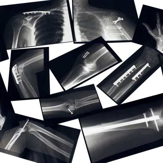 Fixed Bones X-Ray Set {3}