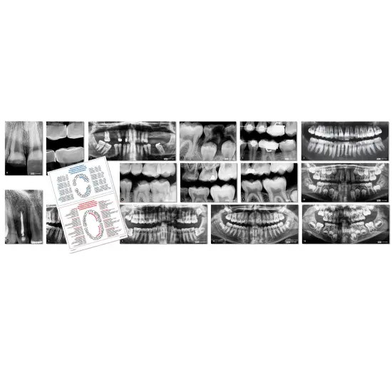 Dental X-Rays {2}