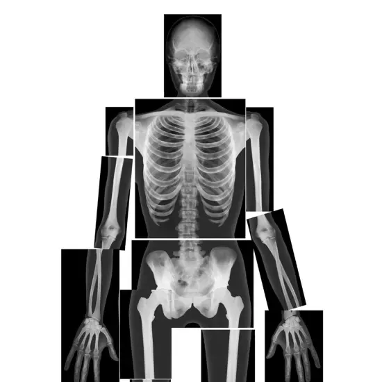 True to Life Human X-Ray Set, Pack of 18 {2}