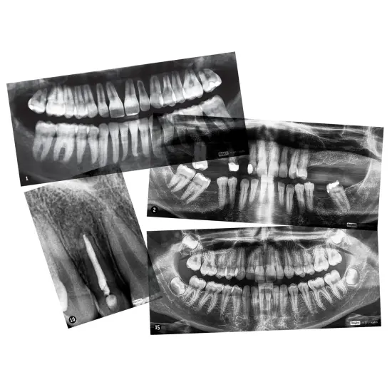 Dental X-Rays {3}