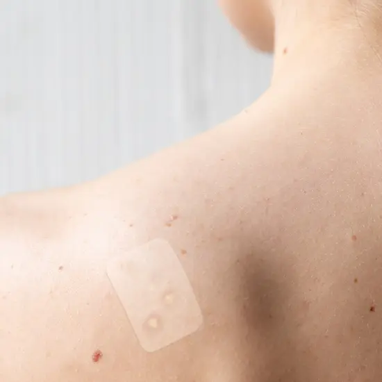 Truly Clear: Hydrocolloid Acne Fighting Target Patches - 42ct - 4 Dot & Cover Sizes, Zit-Blemish, Face-Body, Vegan Skincare, Overnight Spot Treatment {7}