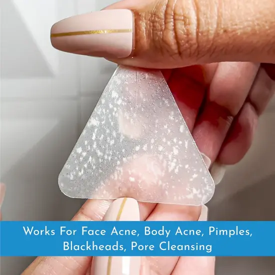 Truly Clear: Hydrocolloid Acne Fighting Zone Patches - 10ct - 3 Sizes, Zit & Blemish Covers, Face & Body, Vegan Skincare, Overnight Spot Treatment {7}