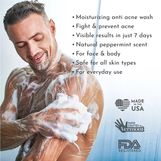 Truly Clear: One-Step Acne Solution Bar - Plant Based Soap, 1% Salicylic Acid, Hyaluronic Acid, Face & Body Cleansing, Non-Drying Skincare Treatment {6}