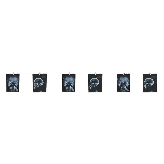 Garland Torture X-Ray 63 In {4}