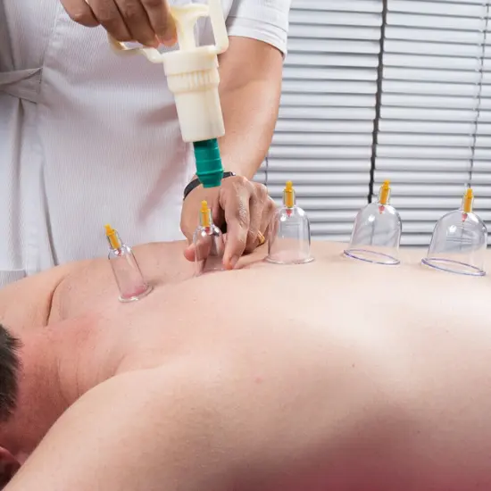 24-Cup Cupping Therapy Set with Magnetic Acupressure Needles - 5 Sizes (2.3"-1") for Full Body Pain Relief, Detachable Self-Use Kit for Blood Circulation & Muscle Recovery {6}