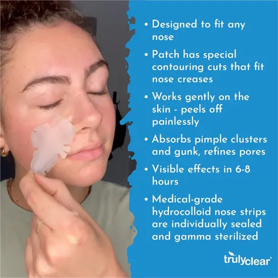 Truly Clear: Hydrocolloid Acne Fighting Nose Patches - 10ct - Face Zit & Blemish Covers, Contoured Design, Vegan Skincare, Overnight Spot Treatment {6}