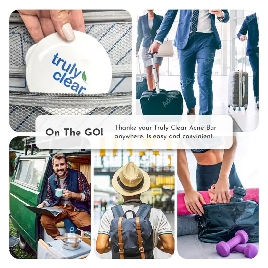 Truly Clear: Keep Dry Soap Case - 3pc Design, Holder For Acne Solution Bar, Draining Tray, Leakproof, Portable Wet Soap Container, Gym-Shower-Carry On {6}