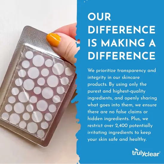 Truly Clear: Hydrocolloid Acne Fighting Super Dots - 72ct - 2 Size Patches, Zit & Blemish Covers, Face-Body, Vegan Skincare, Overnight Spot Treatment {7}