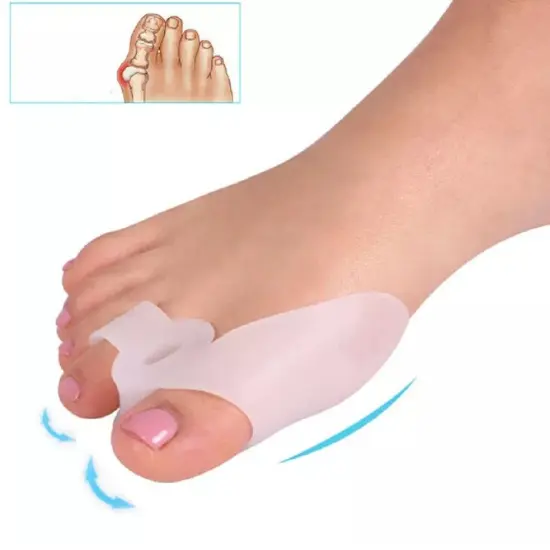 Kitcheniva Silicone Gel Bunion Toe Corrector {1}