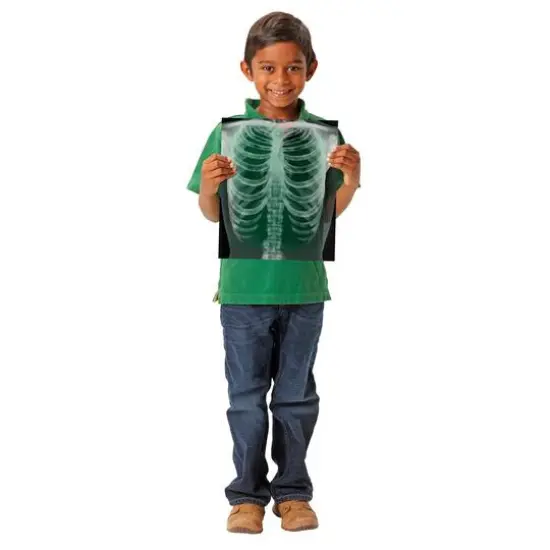 Roylco&reg; True to Life Human X-Ray Set, Pack of 18 {3}