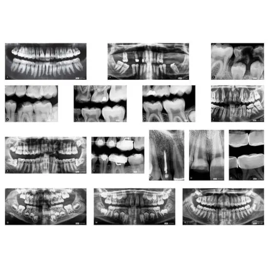 Roylco&reg; Dental X-Rays {1}
